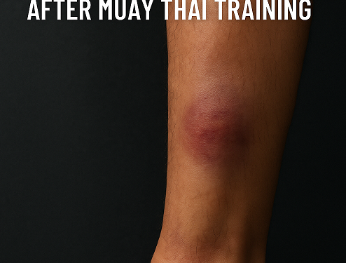 How to Reduce Shin Swelling After Muay Thai Training